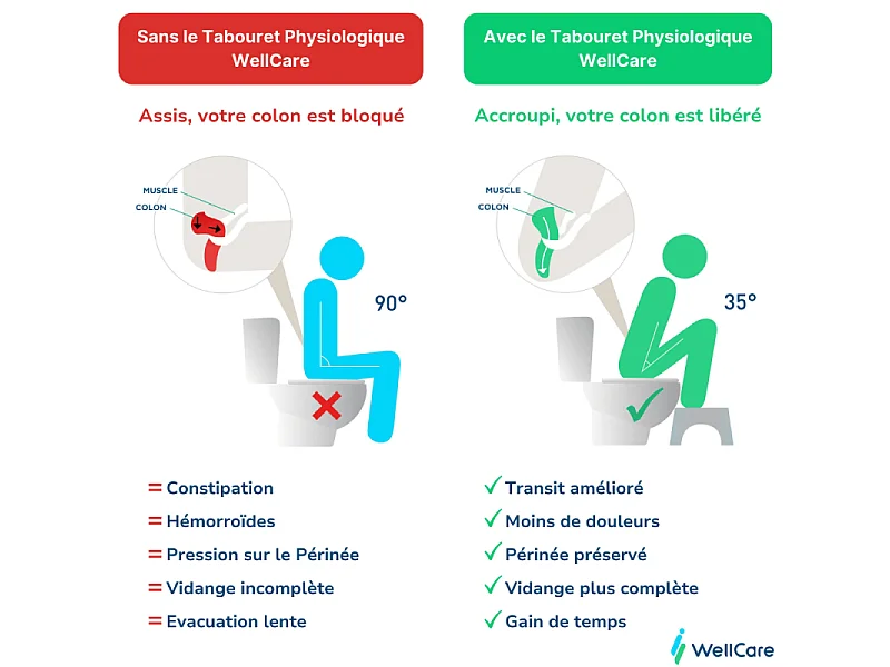 Pack WC sans bride VILLEROY ET BOCH Subway 2.0 abattant frein de chute + bâti-support sol et mur+ plaque blanche + Tabouret blanc